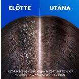 Head and Shoulders Sampon 400ml Anti Hair Fall