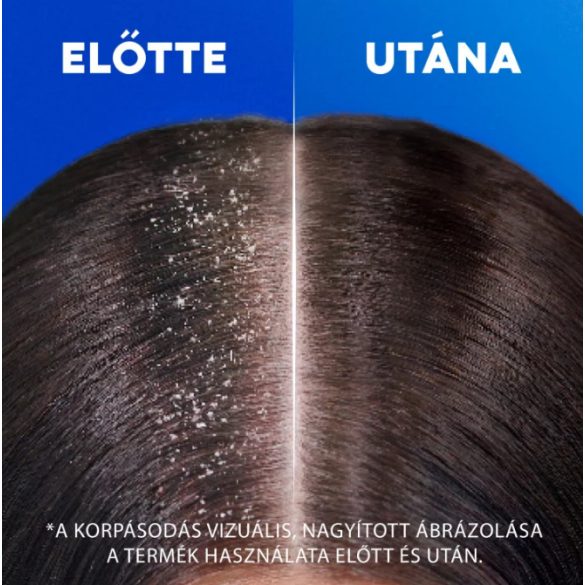 Head and Shoulders Sampon 400ml Anti Hair Fall